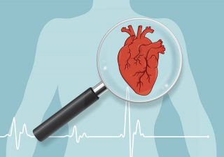 Bệnh thiếu máu cơ tim là gì? Nguyên nhân và triệu chứng của bệnh