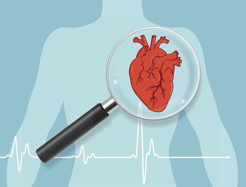 Bệnh thiếu máu cơ tim là gì? Nguyên nhân và triệu chứng của bệnh